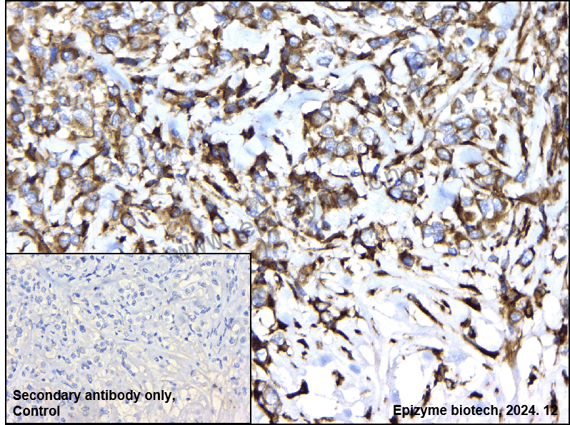 Anti-NLK Rabbit mAb [51G94M39]