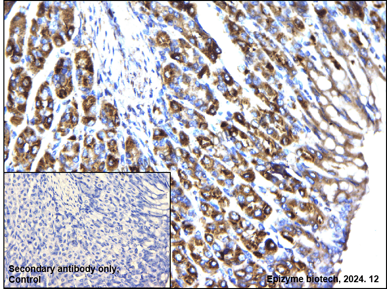 Anti-NLK Rabbit mAb [51G94M39]