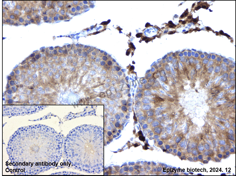Anti-NXF1 Rabbit mAb [71L76E55]