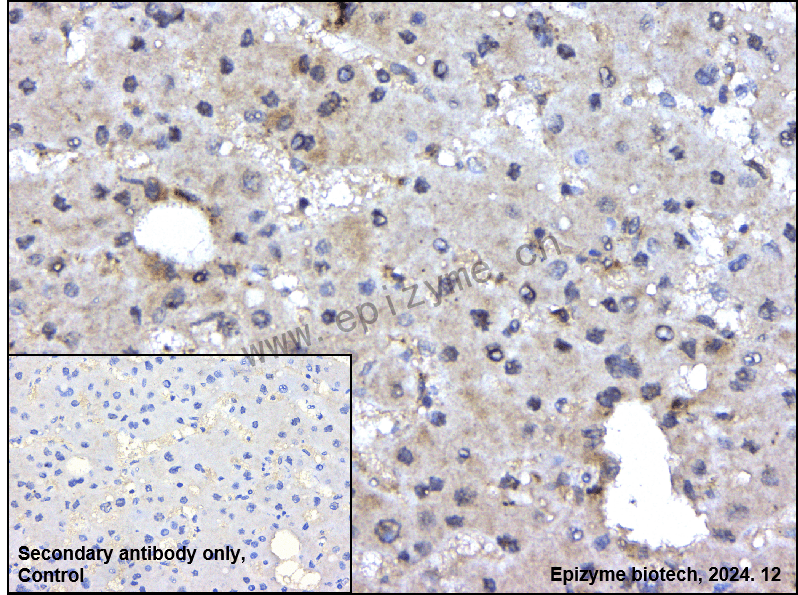 Anti-NXF1 Rabbit mAb [71L76E55]