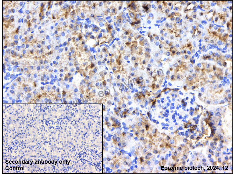 Anti-NXF1 Rabbit mAb [71L76E55]