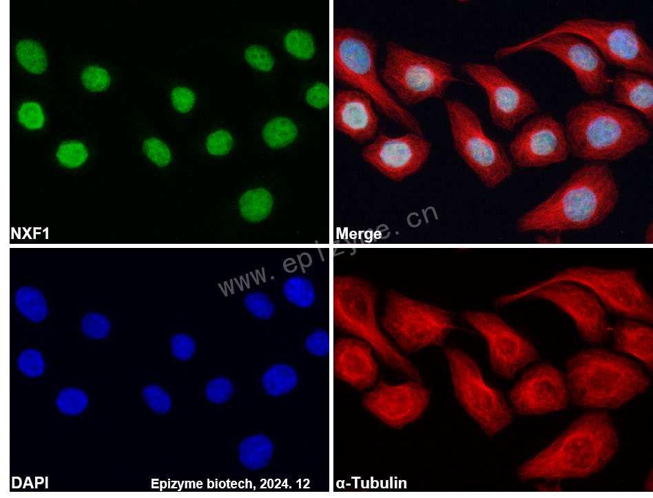 Anti-NXF1 Rabbit mAb [71L76E55]