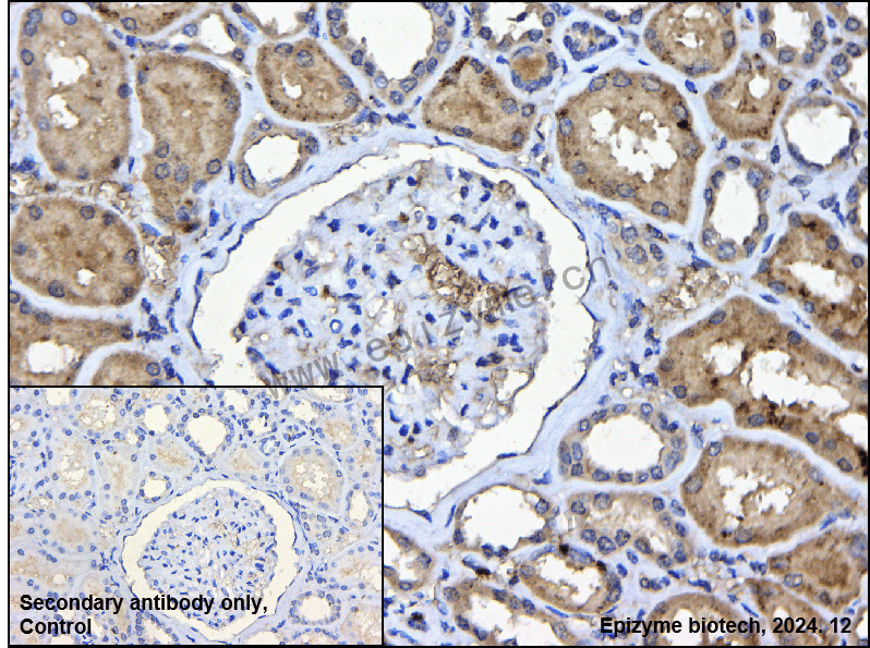 Anti-PAI1 Rabbit mAb [43H86A35]