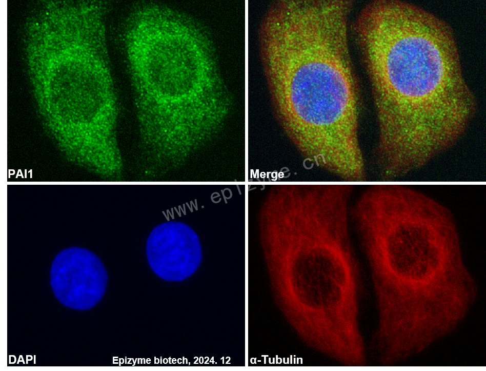 Anti-PAI1 Rabbit mAb [43H86A35]