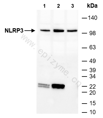 Anti-NLRP3 Rabbit mAb [23R78N45]