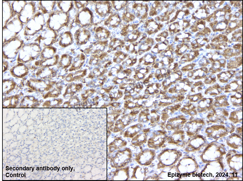 Anti-NLRP3 Rabbit mAb [23R78N45]