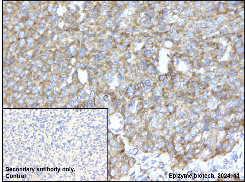Anti-NLRP3 Rabbit mAb [23R78N45]