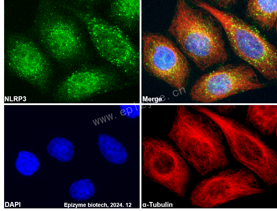 Anti-NLRP3 Rabbit mAb [23R78N45]