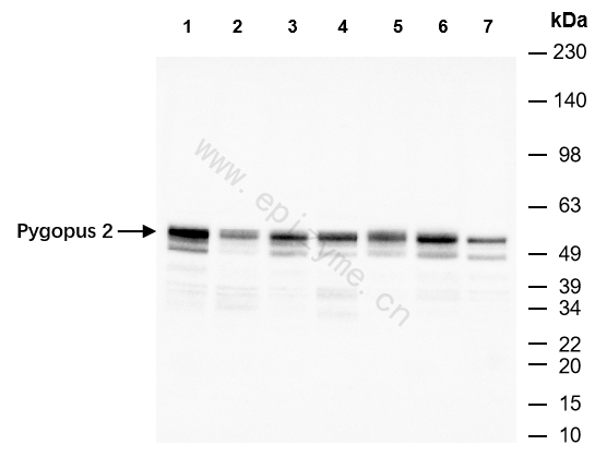 Anti-Pygopus 2 Rabbit mAb [59M32R75]