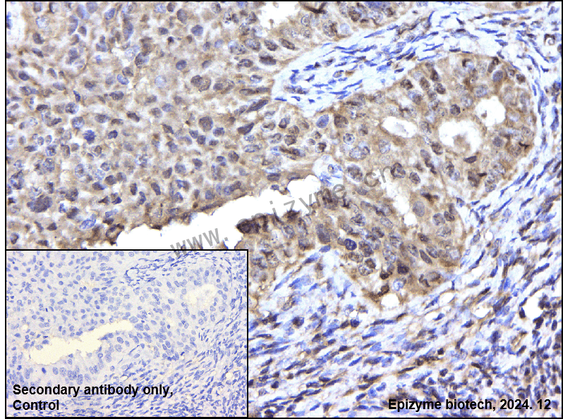 Anti-CDKN2A/p16INK4a Rabbit mAb [62N91M33]