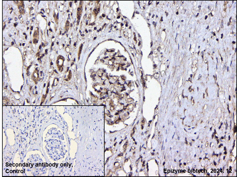 Anti-CDKN2A/p16INK4a Rabbit mAb [62N91M33]