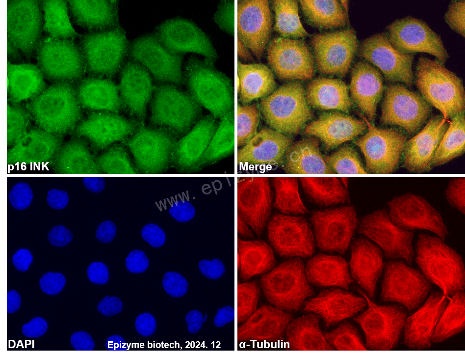 Anti-CDKN2A/p16INK4a Rabbit mAb [62N91M33]