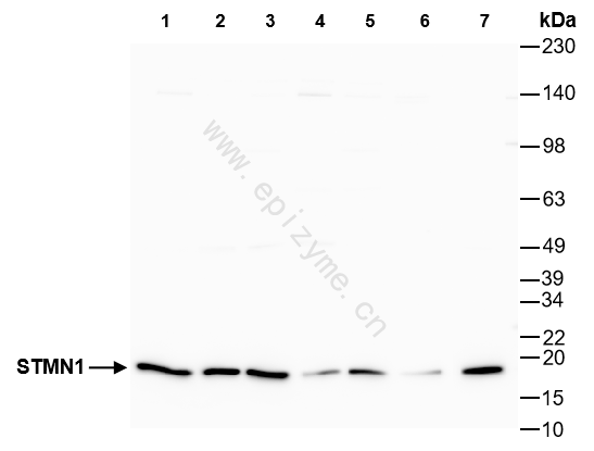 Anti-STMN1 Rabbit mAb [93N60S54]