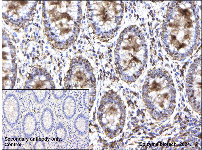 Anti-STMN1 Rabbit mAb [93N60S54]