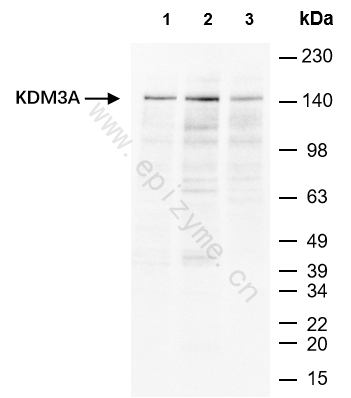 Anti-KDM3A Rabbit mAb [26N90P27]
