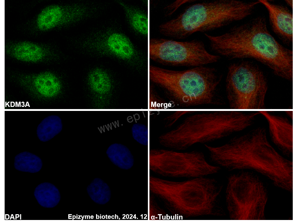 Anti-KDM3A Rabbit mAb [26N90P27]