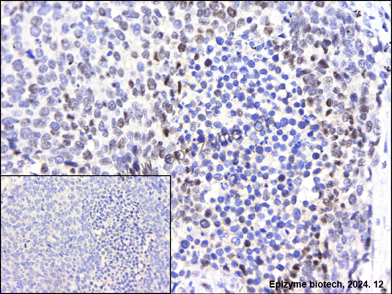 Anti-KDM3A Rabbit mAb [26N90P27]