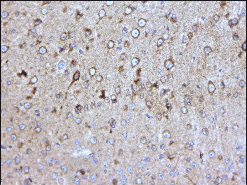 Anti-GAB2 Rabbit mAb [39F73H98]