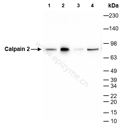 Anti-Calpain 2 Rabbit mAb [98N06F86]