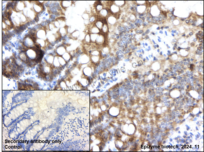 Anti-HtrA2/Omi Rabbit mAb [19D43C52]