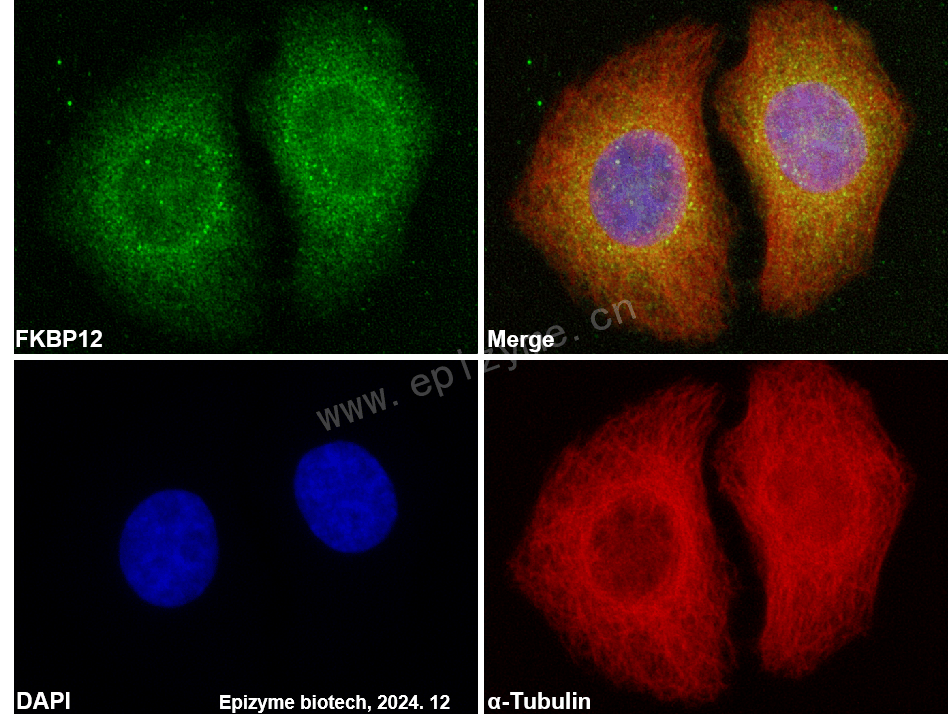 Anti-FKBP12 Rabbit mAb [35Q41K33]