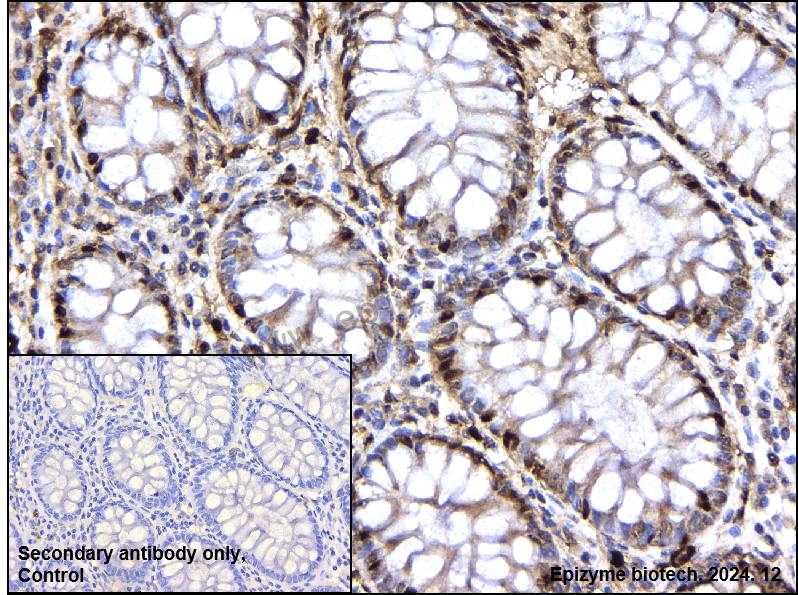 Anti-HNF-4-alpha Rabbit mAb [70L09C17]
