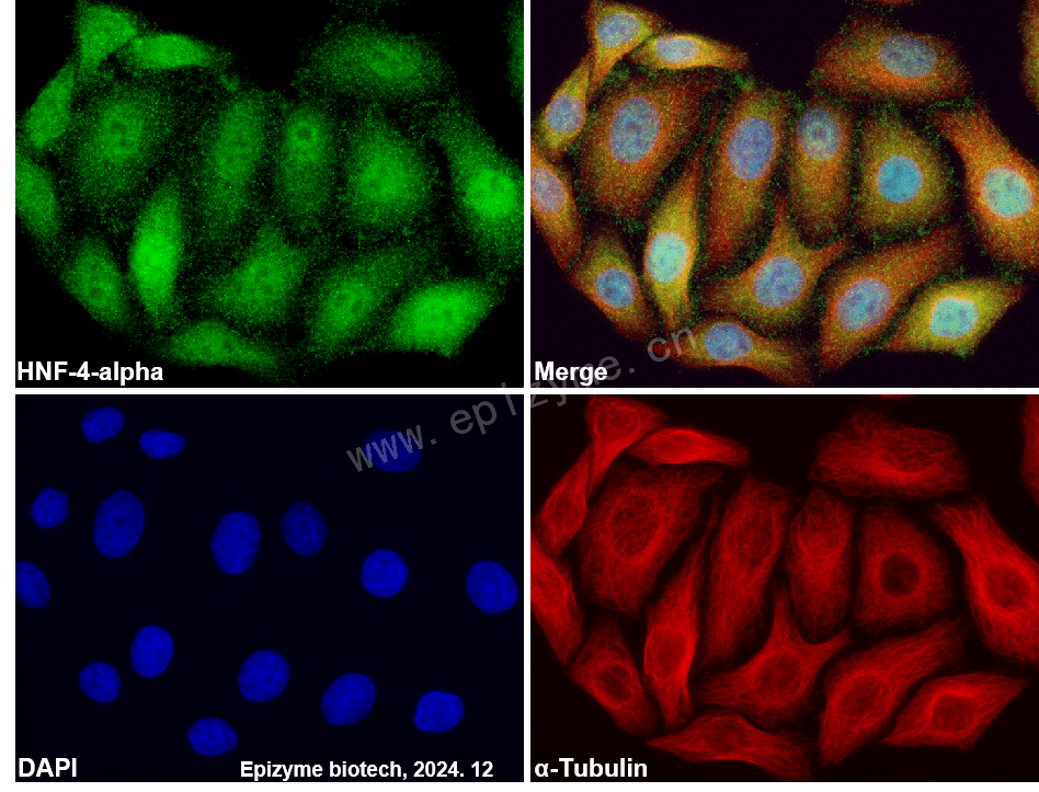 Anti-HNF-4-alpha Rabbit mAb [70L09C17]