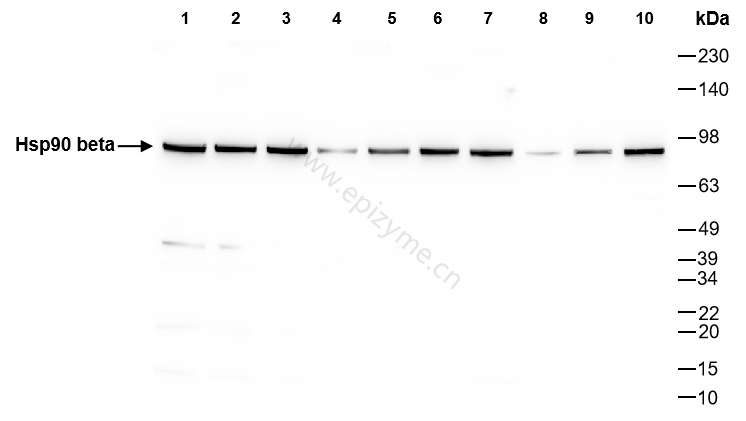 Anti-Hsp90 beta Rabbit mAb [34B09J15]
