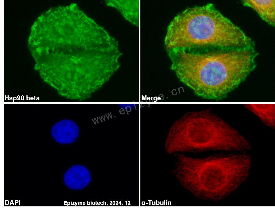 Anti-Hsp90 beta Rabbit mAb [34B09J15]