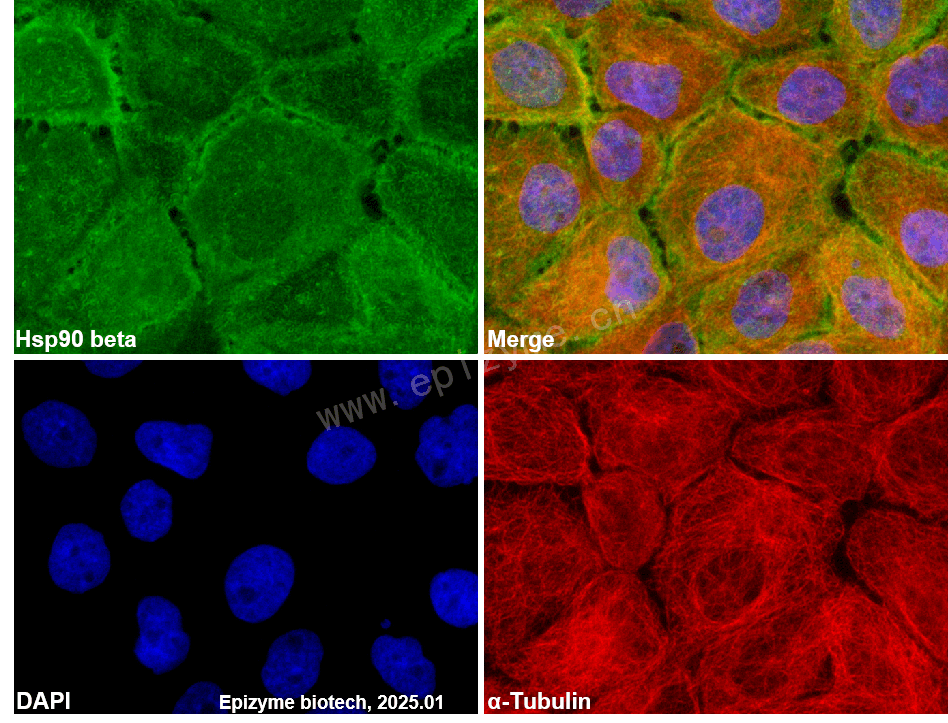 Anti-Hsp90 beta Rabbit mAb [34B09J15]