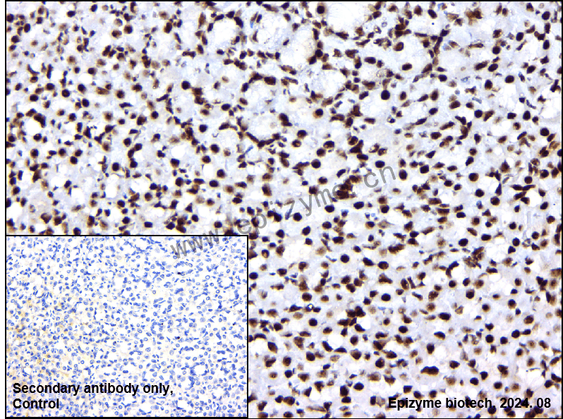Anti-USP39 Rabbit mAb [14I26K30]