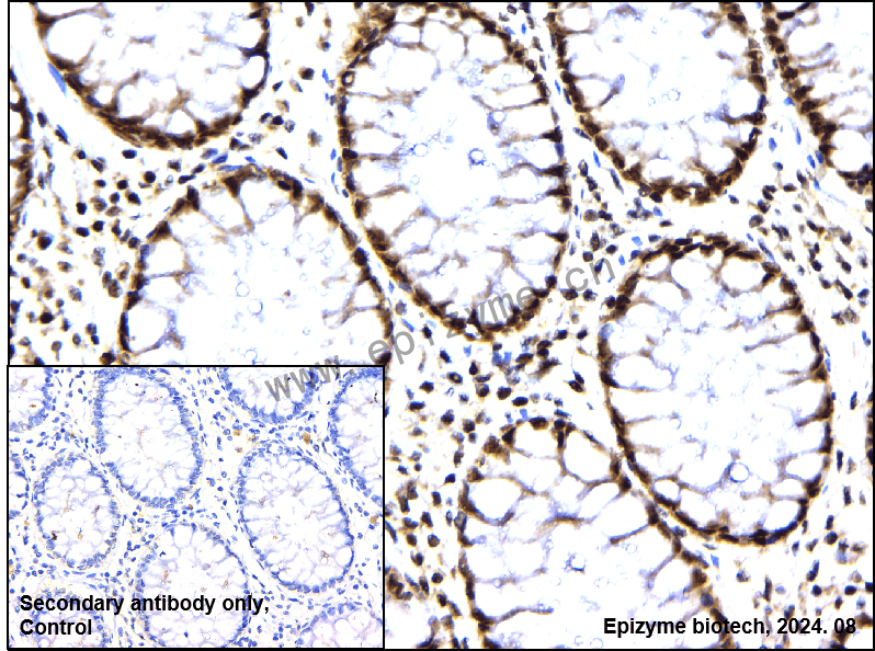 Anti-USP39 Rabbit mAb [14I26K30]