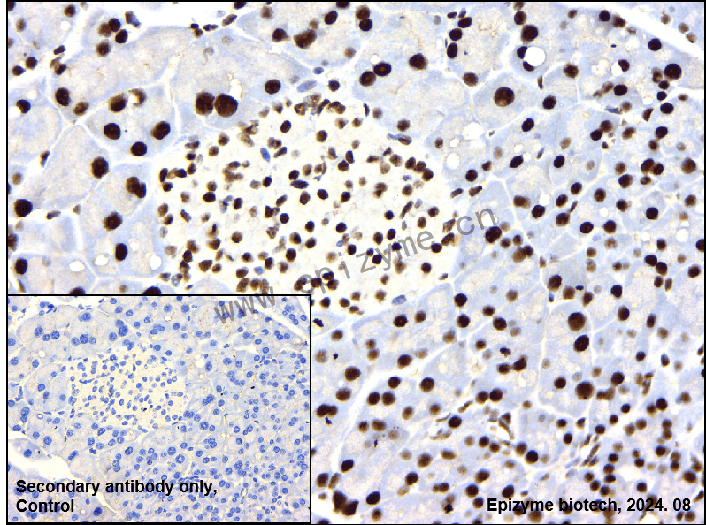 Anti-USP39 Rabbit mAb [14I26K30]
