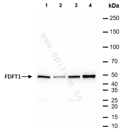 Anti-FDFT1 Rabbit mAb [55R75M66]