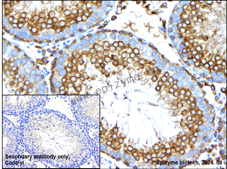 Anti-FDFT1 Rabbit mAb [55R75M66]
