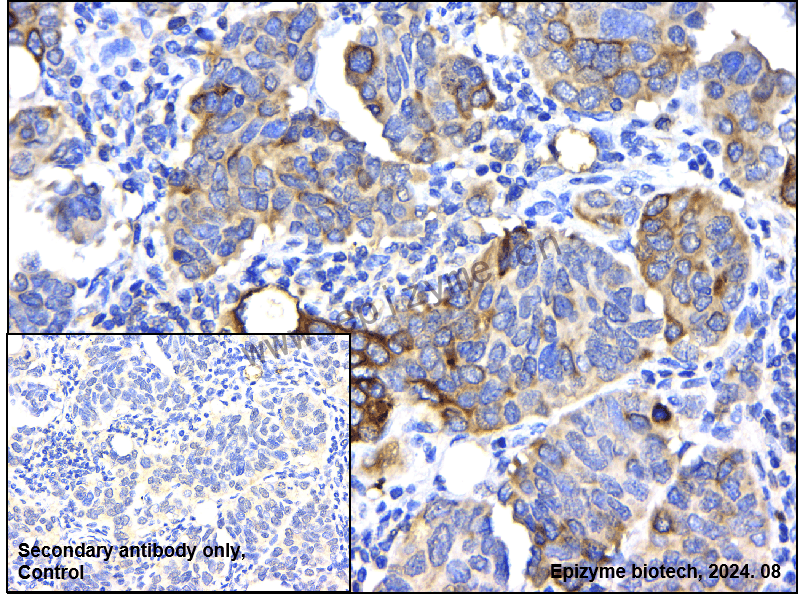 Anti-FDFT1 Rabbit mAb [55R75M66]