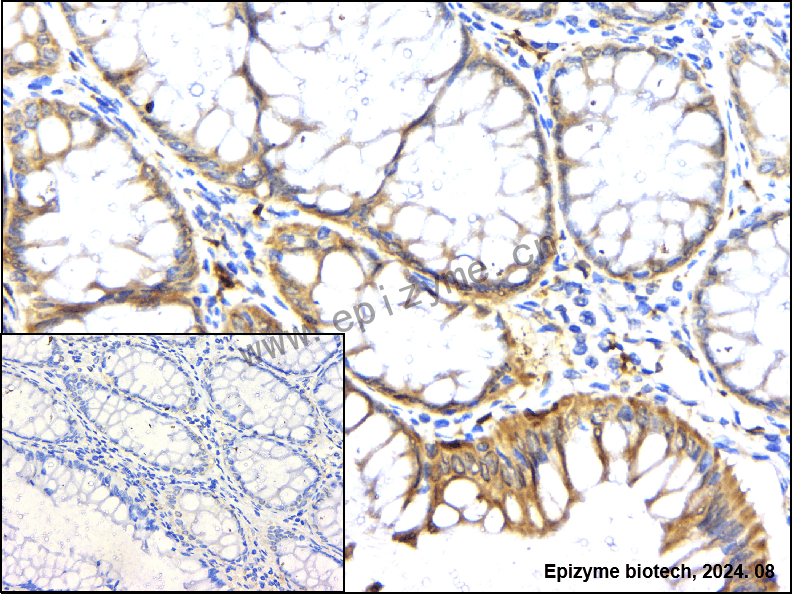 Anti-Heme Oxygenase 1 Rabbit mAb [65J99M24]