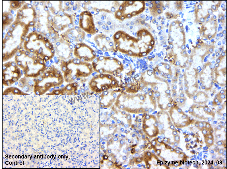 Anti-Heme Oxygenase 1 Rabbit mAb [65J99M24]