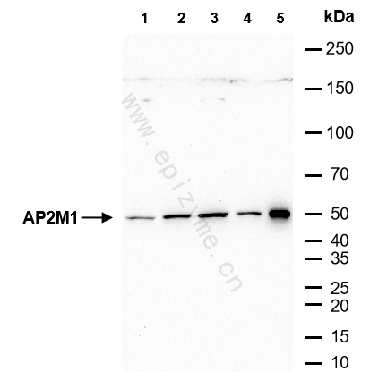 Anti-AP2M1 Rabbit mAb [26E97D88]