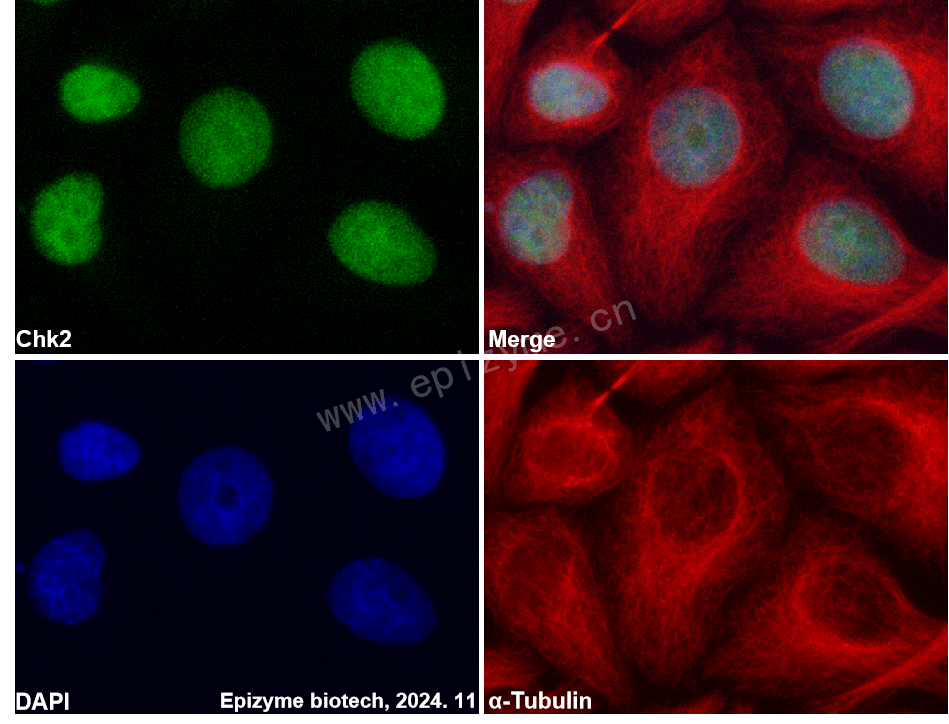 Anti-Chk2 Rabbit mAb [12I51L29]