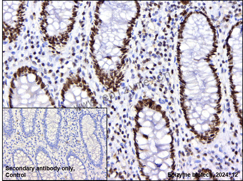 Anti-Chk2 Rabbit mAb [12I51L29]