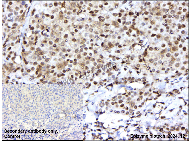 Anti-Chk2 Rabbit mAb [12I51L29]