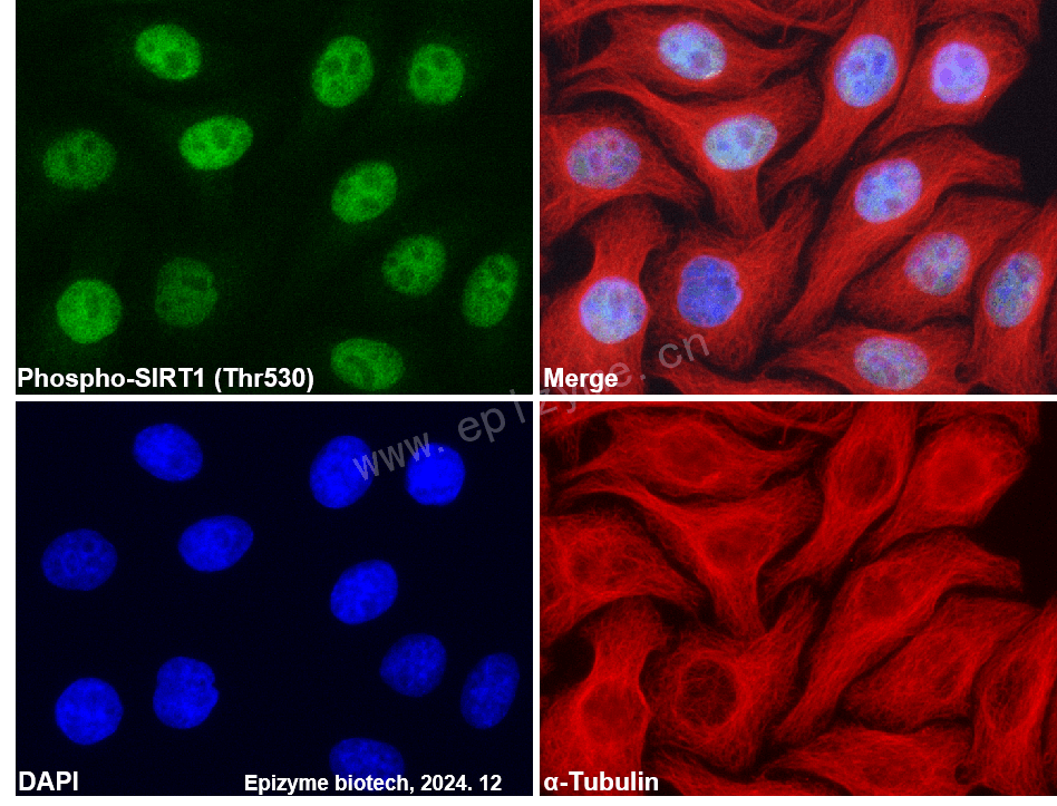 Anti-Phospho-SIRT1 (Thr530) Rabbit mAb [41H77G34]