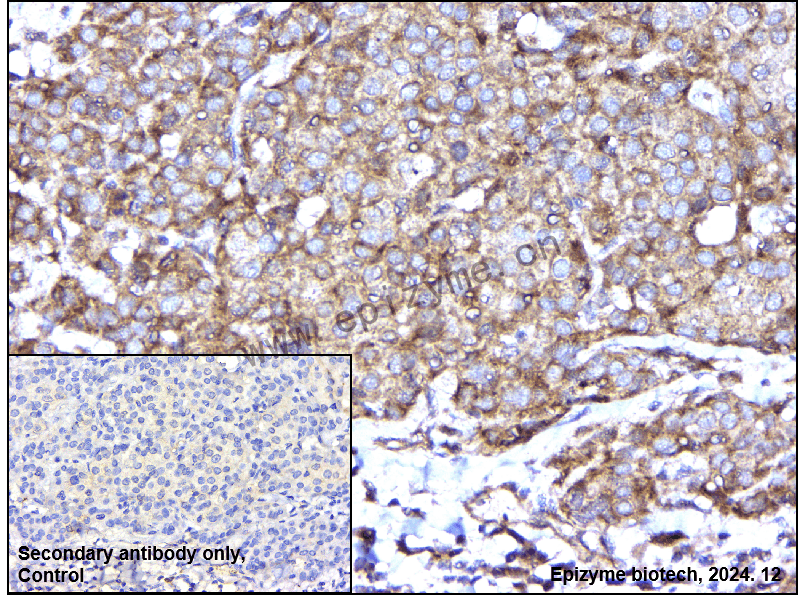 Anti-GAB1 Rabbit mAb [42M64H17]