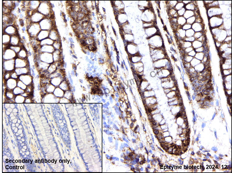 Anti-GAB1 Rabbit mAb [42M64H17]