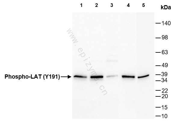 Anti-Phospho-LAT (Tyr 220) Rabbit mAb [12J17C68]