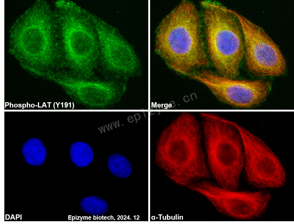 Anti-Phospho-LAT (Tyr 220) Rabbit mAb [12J17C68]