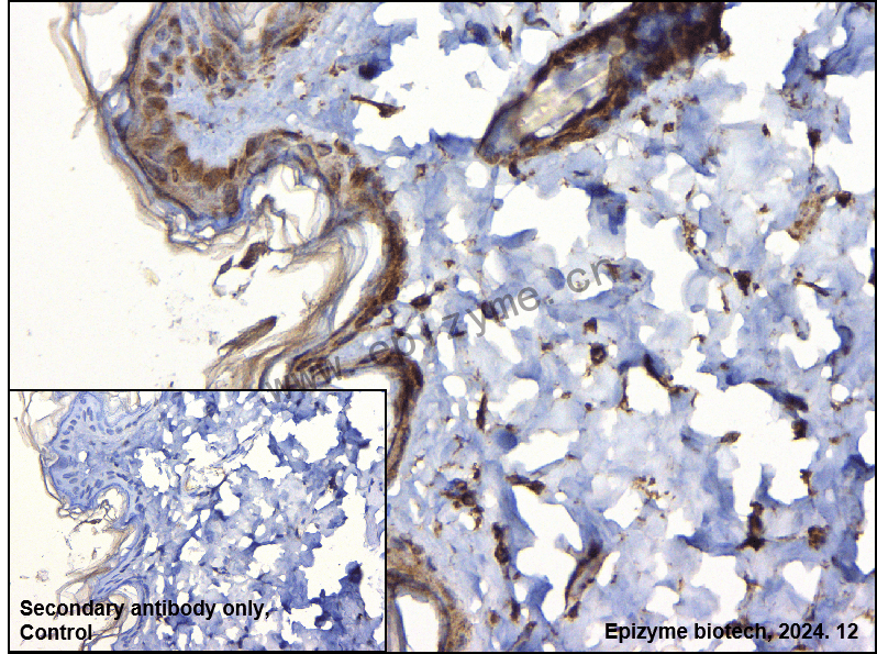Anti-Phospho-LAT (Tyr 220) Rabbit mAb [12J17C68]