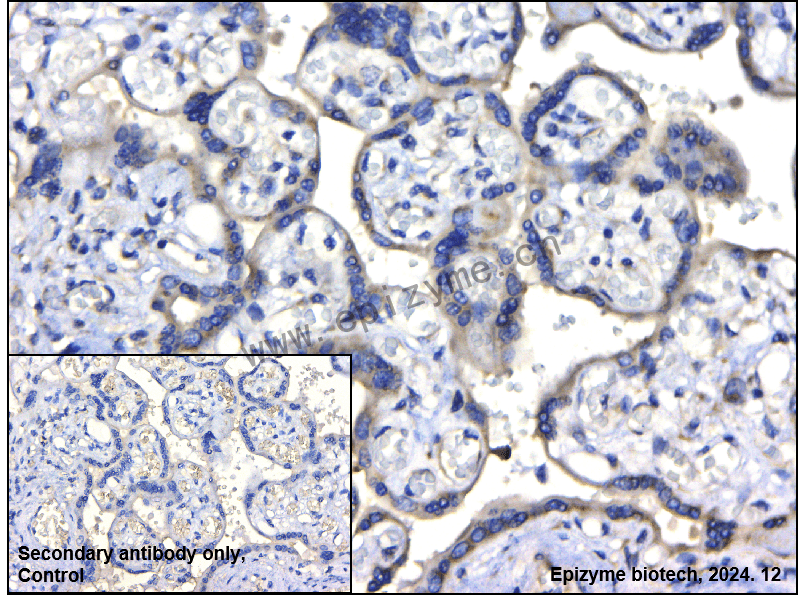 Anti-Phospho-LAT (Tyr 220) Rabbit mAb [12J17C68]