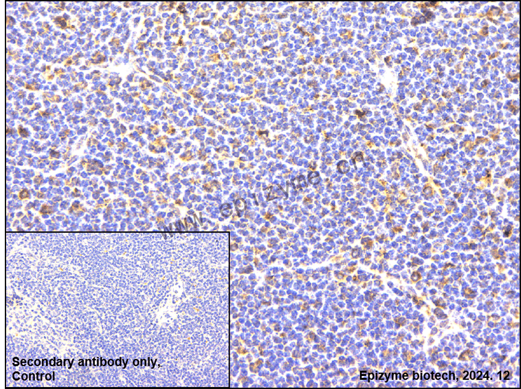 Anti-Phospho-LAT (Tyr 220) Rabbit mAb [12J17C68]